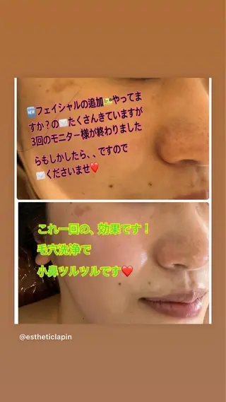 ❤️予約殺到❤️mi オールハンド痩身専門のエステ・リラクイメージ