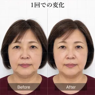小顔・たるみ専門 DAZZLEのエステ・リラクイメージ