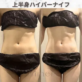 aimer服部 /  小顔 ・ 痩身のその他イメージ