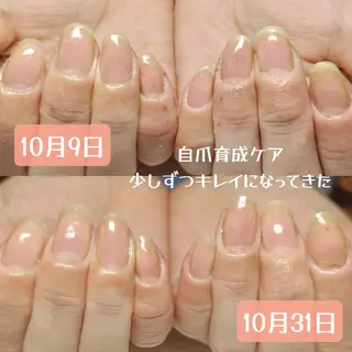 ネイル 深爪矯正/爪育成ケア manie nailのネイルデザイン