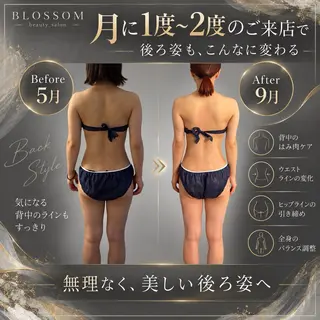 BLOSSOM 菊地のその他イメージ