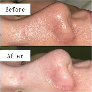 シミ・毛穴専門店 /gracia 安藤のエステ・リラクイメージ