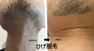 看護師 桐山 まどかのエステ・リラクイメージ