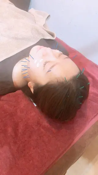 美容鍼灸女性専用 りんご鍼灸治療院のエステ・リラクイメージ