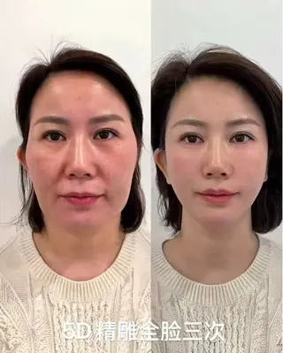 ネイル 愛維美水光専門店 川崎彩鳳のエステ・リラクイメージ