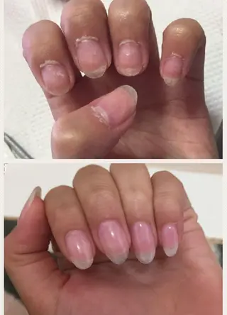 ネイル 野澤 美優のネイルデザイン