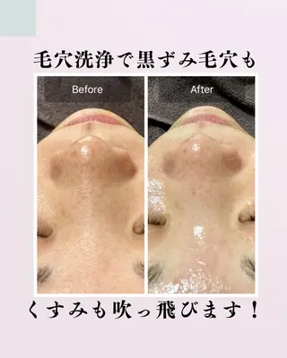 肌質改善サロン facialmoonのエステ・リラクイメージ