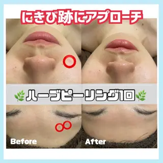 オールハンド専門🤍 痩身/小顔/ ハーブのエステ・リラクイメージ
