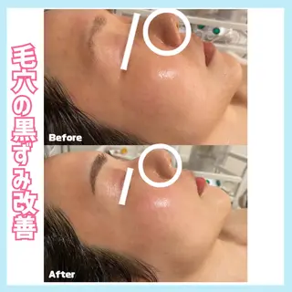 オールハンド専門🤍 痩身/小顔/ ハーブのエステ・リラクイメージ