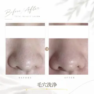 《 肌質×美肌 》 addissimoのエステ・リラクイメージ