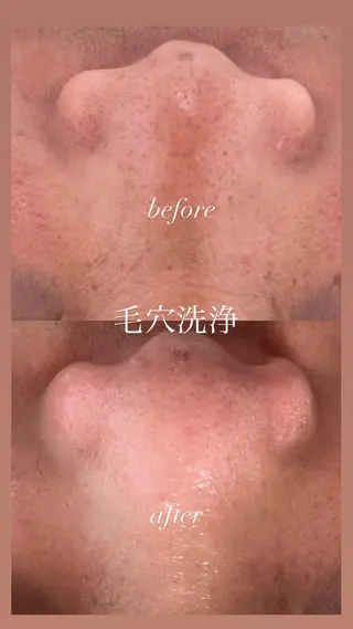 メンズ kana .のエステ・リラクイメージ