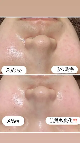 看護師 桐山 まどかのエステ・リラクイメージ