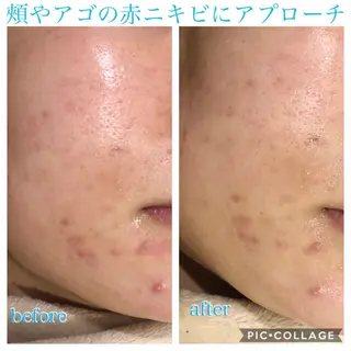 ショート カラー パーマ ヘアアレンジ キッズ ネイル マツエク・マツパ EnsorClair 代表 野口真央のエステ・リラクイメージ