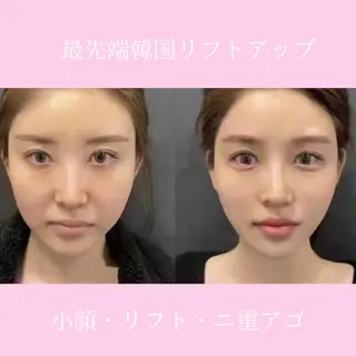 ネイル 愛維美水光専門店 川崎彩鳳のエステ・リラクイメージ