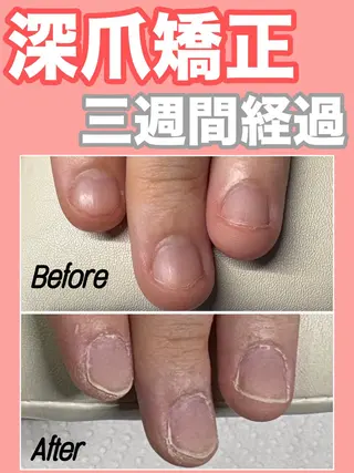 ネイル nail salon petillantのネイルデザイン