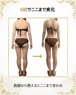 筋膜×深部温熱 リラク★痩身RIONのエステ・リラクイメージ