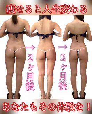 痩身ダイエット&小顔 🩷アールズスリムのエステ・リラクイメージ