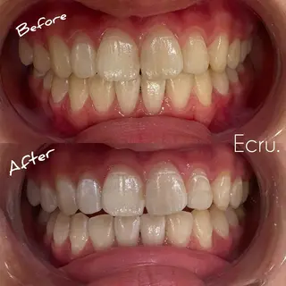 キッズ ホワイトニングサロン Ecru エクリュのその他イメージ