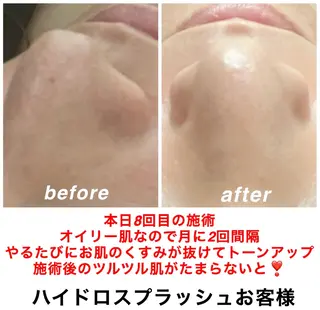 ネイル・エステサロン UILANIのエステ・リラクイメージ