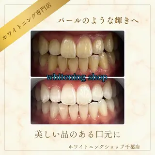 メンズ ホワイトニング ショップ千葉店のその他イメージ