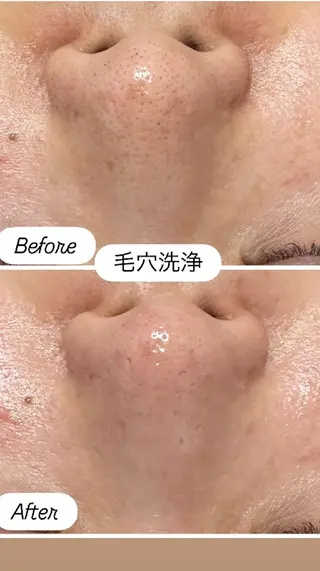 看護師 桐山 まどかのエステ・リラクイメージ