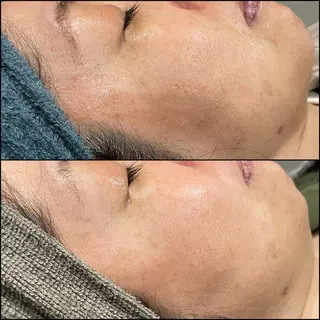 LiZA エステティックサロンのエステ・リラクイメージ