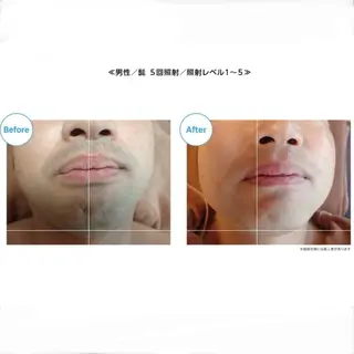脱毛サロン MiELのエステ・リラクイメージ