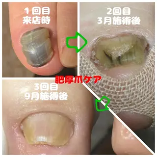 メンズ ドクターネイル爪革命 takahashiのその他イメージ