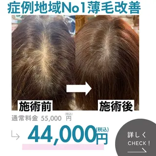 最速 毛穴シミ改善 いくえのその他イメージ