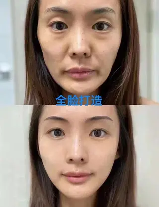 マツエク・マツパ 愛維美水光専門店 川崎彩鳳のエステ・リラクイメージ