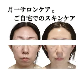 看護師 AYUIのエステ・リラクイメージ