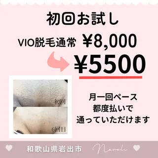 切らない脂肪吸引🔥 Neroliまりこのエステ・リラクイメージ