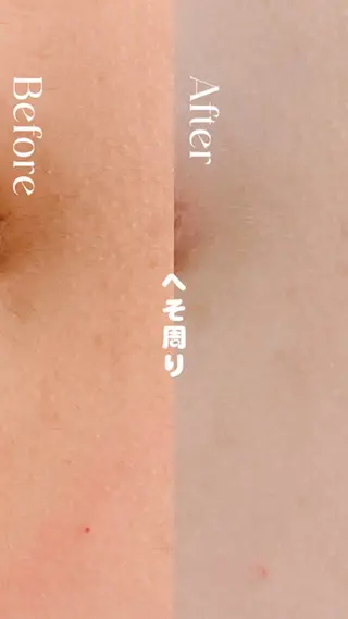 豊橋 |Hitomi シュガーリング専門店のその他イメージ