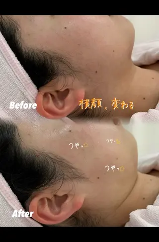 🫧美しい素肌へ🫧 今成柚乃のその他イメージ