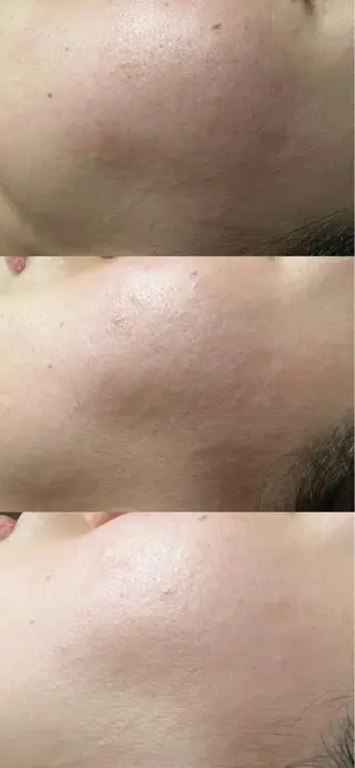 lymph care 'Welnəsのエステ・リラクイメージ