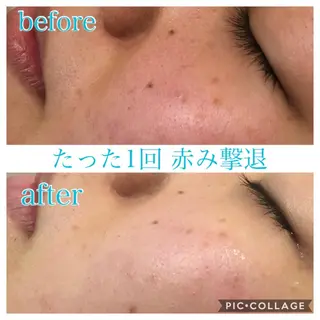 ショート カラー パーマ ヘアアレンジ キッズ ネイル マツエク・マツパ EnsorClair 代表 野口真央のエステ・リラクイメージ