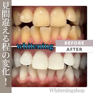 ホワイトニング ショップ船橋店のエステ・リラクイメージ