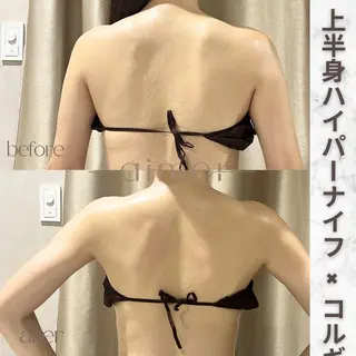 aimer服部 /  小顔 ・ 痩身のその他イメージ