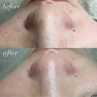 beauty salonWのエステ・リラクイメージ