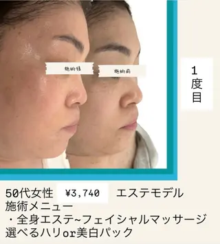 丸￤POLA南船場 エステ￤肌質改善のエステ・リラクイメージ