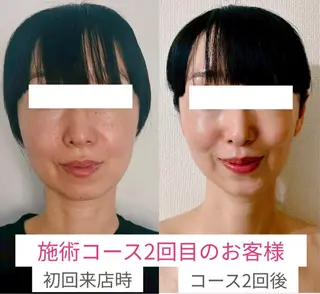 小顔サロン (ラ リュミエール)のエステ・リラクイメージ