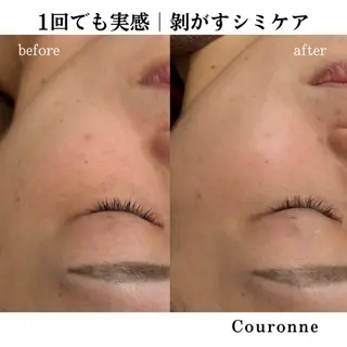 シミ・毛穴ケア専門 クロヌYUKIのエステ・リラクイメージ