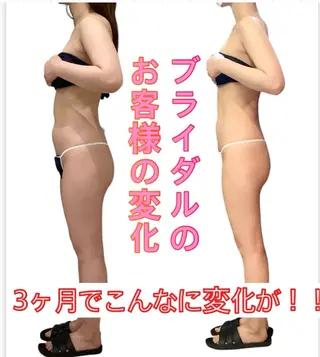 痩身ダイエット&小顔 🩷アールズスリムのエステ・リラクイメージ