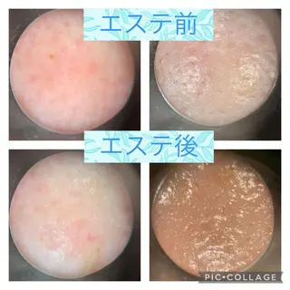 丸の内ヒルズ 今井琴恵のエステ・リラクイメージ