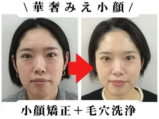 小顔矯正＆肌質改善 BUPURA岡山のエステ・リラクイメージ