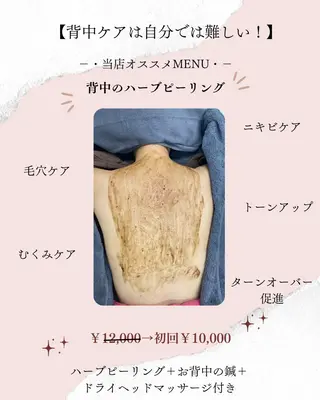 肌質改善美容鍼 ×ハーブピーリングのエステ・リラクイメージ