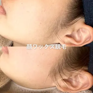 顔ワックス脱毛/ ハーブピーリングのエステ・リラクイメージ