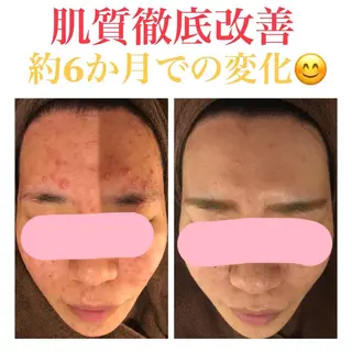 ミディアム カラー パーマ ヘアアレンジ メンズ キッズ ネイル マツエク・マツパ ニキビ・肌質改善専門 ♡人生が変わるサロンのエステ・リラクイメージ