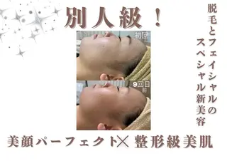 🎀美肌ケアサロン 🎀レイビス銀座店のエステ・リラクイメージ