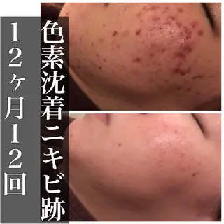 ミディアム カラー パーマ ヘアアレンジ メンズ キッズ ネイル マツエク・マツパ ニキビ・肌質改善専門 ♡人生が変わるサロンのエステ・リラクイメージ